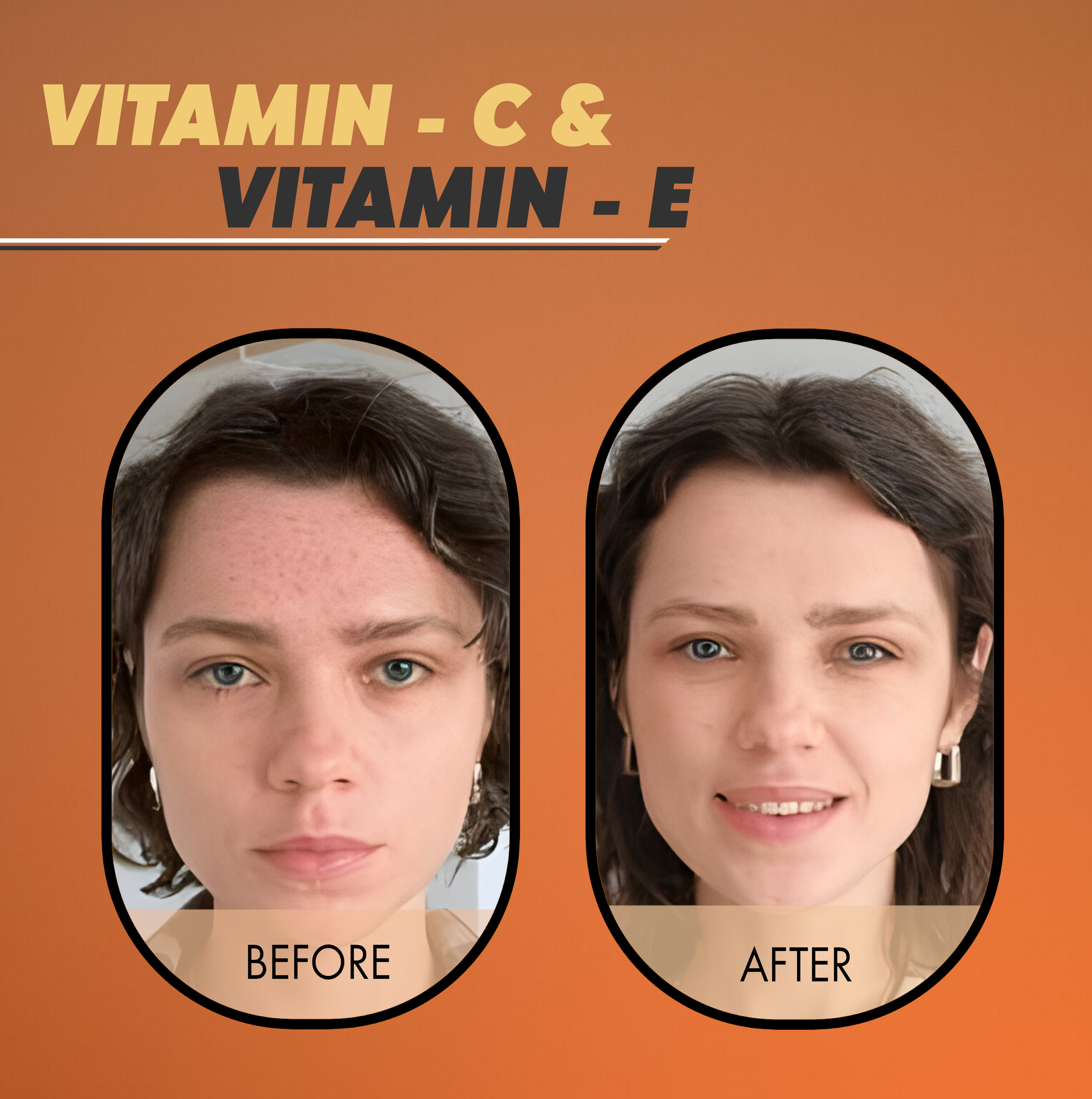 5% Vitamin C Serum - 30oz